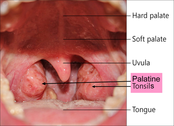 Normal palatine tonsils